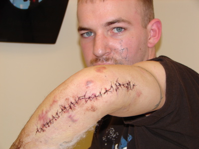 stitches.jpg