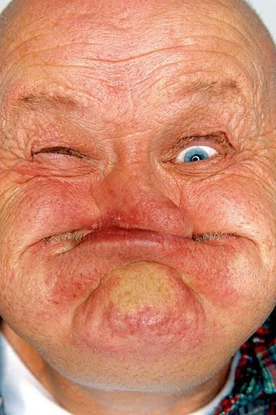 gurning-pic.jpg